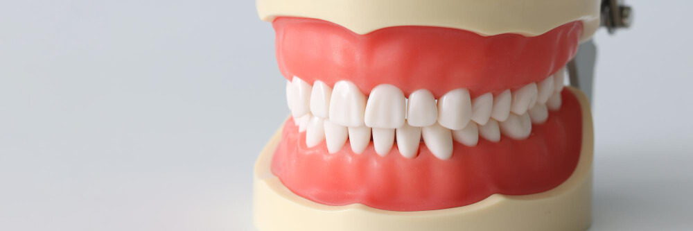 انواع جسر الأسنان