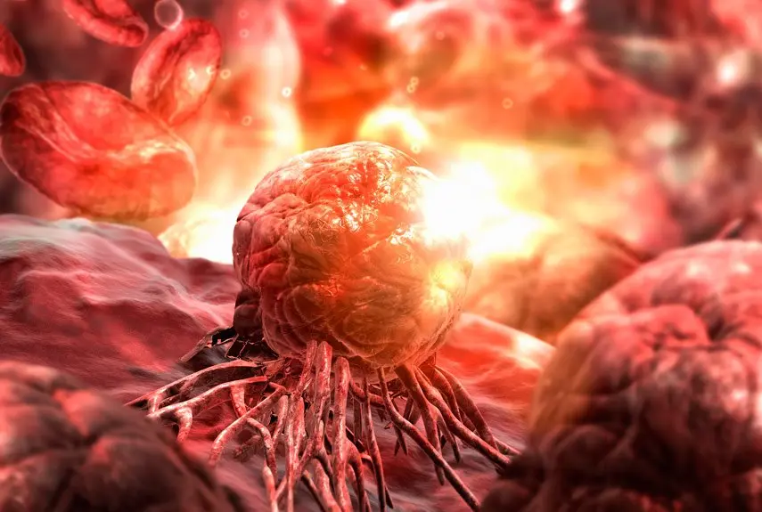 تنتشر الخلايا السرطانية إلى الأنسجة: