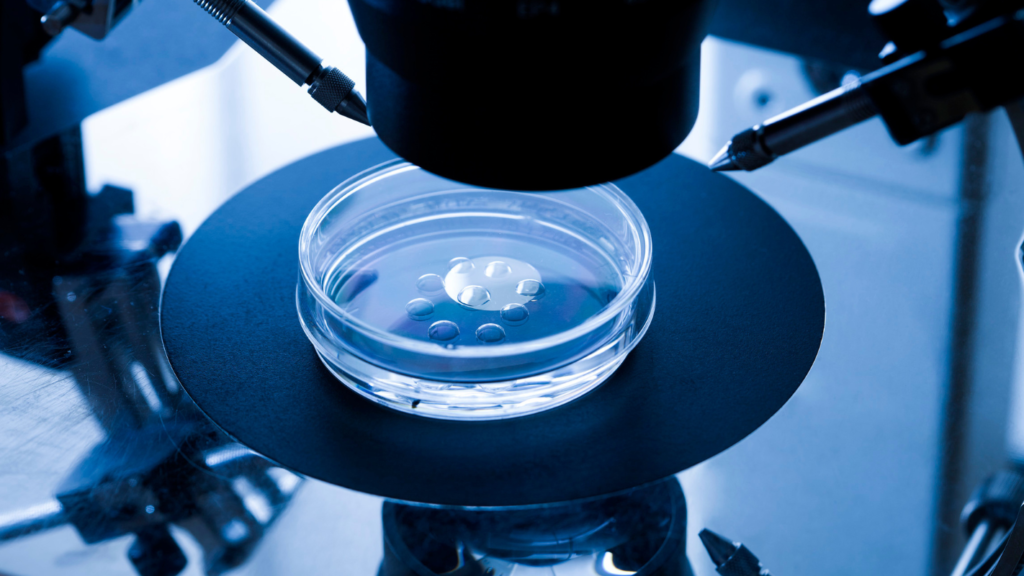 ترجيع الأجنة المجمدة 4 الحقن المجهري